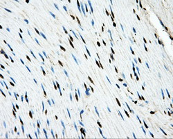 LOX / Lysyl Oxidase Antibody - IHC of paraffin-embedded colon tissue using anti-LOX mouse monoclonal antibody. (Dilution 1:50).