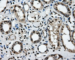 LOX / Lysyl Oxidase Antibody - IHC of paraffin-embedded Kidney tissue using anti-LOX mouse monoclonal antibody. (Dilution 1:50).