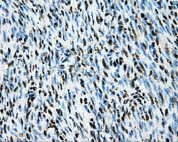 LOX / Lysyl Oxidase Antibody - IHC of paraffin-embedded endometrium tissue using anti-LOX mouse monoclonal antibody. (Dilution 1:50).
