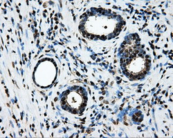 LOX / Lysyl Oxidase Antibody - IHC of paraffin-embedded prostate tissue using anti-LOX mouse monoclonal antibody. (Dilution 1:50).