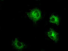 LOX / Lysyl Oxidase Antibody - Anti-LOX mouse monoclonal antibody  immunofluorescent staining of COS7 cells transiently transfected by pCMV6-ENTRY LOX.