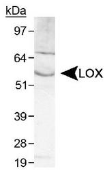 LOX / Lysyl Oxidase Antibody - Detection of LOX in human kidney lysate.  This image was taken for the unconjugated form of this product. Other forms have not been tested.