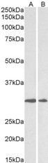 LOX / Lysyl Oxidase Antibody - Goat anti-lysyl oxidase Antibody (0.5µg/ml) staining of Human Heart (A) and Placenta (B) lysates (35µg protein in RIPA buffer). Primary incubation was 1 hour. Detected by chemiluminescencence.