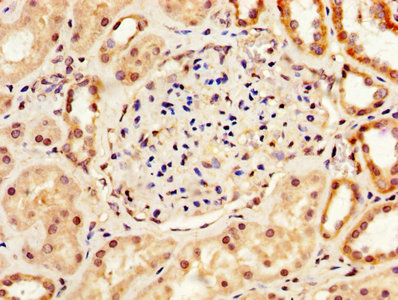 LOX / Lysyl Oxidase Antibody - IHC image of LOX Antibody diluted at 1:200 and staining in paraffin-embedded human kidney tissue performed on a Leica BondTM system. After dewaxing and hydration, antigen retrieval was mediated by high pressure in a citrate buffer (pH 6.0). Section was blocked with 10% normal goat serum 30min at RT. Then primary antibody (1% BSA) was incubated at 4°C overnight. The primary is detected by a biotinylated secondary antibody and visualized using an HRP conjugated SP system.