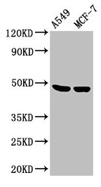 LOX / Lysyl Oxidase Antibody - Western Blot Positive WB detected in: A549 whole cell lysate, MCF-7 whole cell lysate All lanes: LOX antibody at 3.6µg/ml Secondary Goat polyclonal to rabbit IgG at 1/50000 dilution Predicted band size: 47 kDa Observed band size: 47 kDa