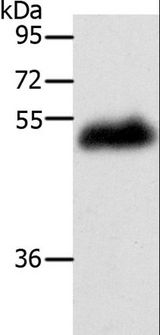 LOX / Lysyl Oxidase Antibody - Western blot analysis of Human leiomyosarcoma tissue, using LOX Polyclonal Antibody at dilution of 1:400.