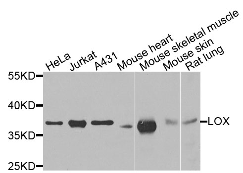 LOX / Lysyl Oxidase Antibody - Western blot analysis of extracts of various cells.