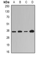LOX / Lysyl Oxidase Antibody - Western blot analysis of LOX expression in Jurkat (A); A431 (B); mouse heart (C); rat lung (D) whole cell lysates.