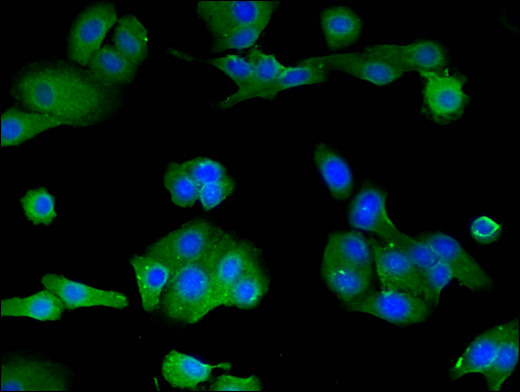 LOXHD1 Antibody - Immunofluorescent analysis of HepG2 cells using LOXHD1 Antibody at a dilution of 1:100 and Alexa Fluor 488-congugated AffiniPure Goat Anti-Rabbit IgG(H+L)