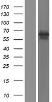 LOXHD1 Protein - Western validation with an anti-DDK antibody * L: Control HEK293 lysate R: Over-expression lysate