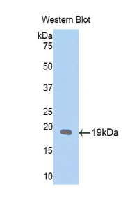LOXL1 Antibody - Western blot of recombinant LOXL / LOXL1.  This image was taken for the unconjugated form of this product. Other forms have not been tested.