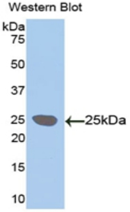 LOXL1 Antibody - Western blot of recombinant LOXL / LOXL1.  This image was taken for the unconjugated form of this product. Other forms have not been tested.