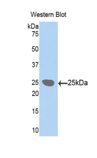 LOXL1 Antibody - Western blot of recombinant LOXL / LOXL1.  This image was taken for the unconjugated form of this product. Other forms have not been tested.