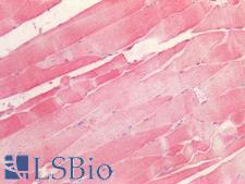 LOXL1 Antibody - Human Skeletal Muscle: Formalin-Fixed, Paraffin-Embedded (FFPE)