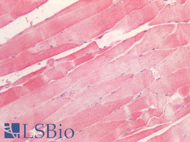 LOXL1 Antibody - Human Skeletal Muscle: Formalin-Fixed, Paraffin-Embedded (FFPE)