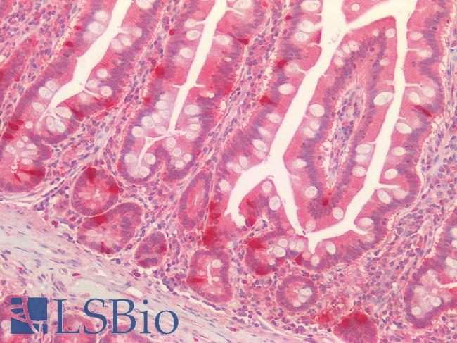 LOXL1 Antibody - Human Small Intestine: Formalin-Fixed, Paraffin-Embedded (FFPE)