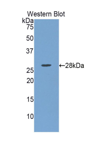 LOXL1 Antibody - Western blot of recombinant LOXL / LOXL1.  This image was taken for the unconjugated form of this product. Other forms have not been tested.