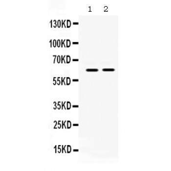 LOXL1 Antibody - LOXL1 antibody Western blot. All lanes: Anti LOXL1 at 0.5 ug/ml. Lane 1: A549 Whole Cell Lysate at 40 ug. Lane 2: HELA Whole Cell Lysate at 40 ug. Predicted band size: 63 kD. Observed band size: 63 kD.