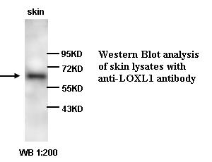 LOXL1 Antibody