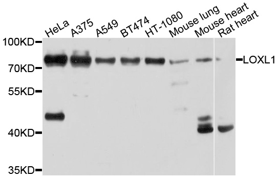 LOXL1 Antibody - Western blot analysis of extracts of various cell lines, using LOXL1 antibody at 1:1000 dilution. The secondary antibody used was an HRP Goat Anti-Rabbit IgG (H+L) at 1:10000 dilution. Lysates were loaded 25ug per lane and 3% nonfat dry milk in TBST was used for blocking. An ECL Kit was used for detection and the exposure time was 5s.