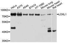 LOXL1 Antibody - Western blot analysis of extracts of various cell lines, using LOXL1 antibody at 1:1000 dilution. The secondary antibody used was an HRP Goat Anti-Rabbit IgG (H+L) at 1:10000 dilution. Lysates were loaded 25ug per lane and 3% nonfat dry milk in TBST was used for blocking. An ECL Kit was used for detection and the exposure time was 5s.