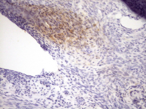 LOXL2 Antibody - Immunohistochemical staining of paraffin-embedded Human endometrium tissue within the normal limits using anti-LOXL2 mouse monoclonal antibody. (Heat-induced epitope retrieval by Tris-EDTA, pH8.0)(1:150)