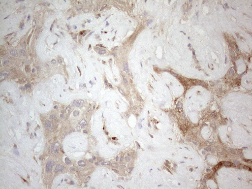 LOXL2 Antibody - Immunohistochemical staining of paraffin-embedded Human liver tissue within the normal limits using anti-LOXL2 mouse monoclonal antibody. (Heat-induced epitope retrieval by 1mM EDTA in 10mM Tris buffer. (pH8.5) at 120°C for 3 min. (1:150)