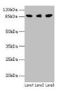 LOXL2 Antibody - Western blot All lanes: Loxl2 antibody at 14µg/ml Lane 1: 293T whole cell lysate Lane 2: A549 whole cell lysate Lane 3: A431 whole cell lysate Secondary Goat polyclonal to rabbit IgG at 1/10000 dilution Predicted band size: 88, 82 kDa Observed band size: 88 kDa