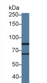 LOXL2 Antibody - Western Blot; Sample: Rat Lung lysate; Primary Ab: 1.5µg/ml Rabbit Anti-Rat LOXL2 Antibody Second Ab: 0.2µg/mL HRP-Linked Caprine Anti-Rabbit IgG Polyclonal Antibody