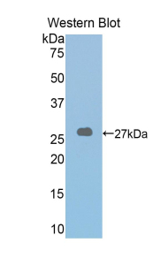 LOXL2 Antibody - Western blot of recombinant LOXL2.  This image was taken for the unconjugated form of this product. Other forms have not been tested.