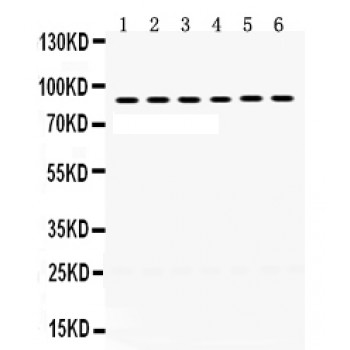 LOXL2 Antibody - LOXL2 antibody Western blot. All lanes: Anti LOXL2 at 0.5 ug/ml. Lane 1: Mouse Testis Tissue Lysate at 50 ug. Lane 2: Rat Ovary Tissue Lysate at 50 ug. Lane 3: Human Placenta Tissue Lysate at 50 ug. Lane 4: HELA Whole Cell Lysate at 40 ug. Lane 5: 22RV1 Whole Cell Lysate at 40 ug. Lane 6: MCF-7 Whole Cell Lysate at 40 ug. Predicted band size: 87 kD. Observed band size: 87 kD.