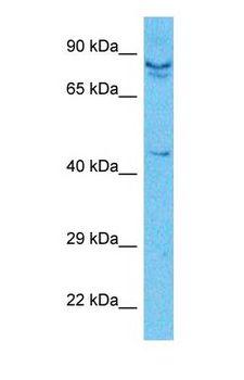 LOXL2 Antibody - Western blot of LOXL2 Antibody with human HepG2 Whole Cell lysate.  This image was taken for the unconjugated form of this product. Other forms have not been tested.