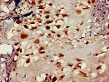 LOXL2 Antibody - Immunohistochemistry of paraffin-embedded human placenta tissue at dilution of 1:100