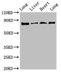 LOXL2 Antibody - Western Blot Positive WB detected in:Rat lung tissue,Rat liver tissue,Mouse heart tissue,Mouse lung tissue All Lanes:LOXL2 antibody at 3.5µg/ml Secondary Goat polyclonal to rabbit IgG at 1/50000 dilution Predicted band size: 87 KDa Observed band size: 87 KDa