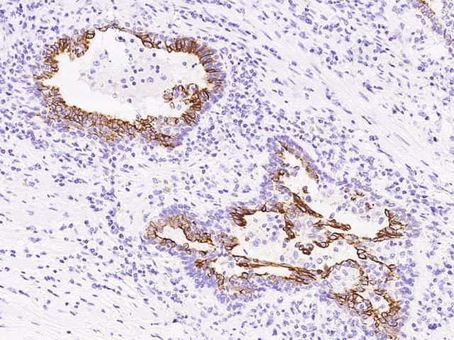 LOXL2 Antibody - Immunochemical staining of human LOXL2 in human prostate with rabbit polyclonal antibody at 1:1000 dilution, formalin-fixed paraffin embedded sections.