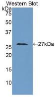 LOXL3 Antibody - Western Blot; Sample: Recombinant protein.