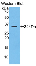 LOXL4 / LOXC Antibody - Western Blot; Sample: Recombinant protein.