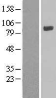 LOXL4 / LOXC Protein - Western validation with an anti-DDK antibody * L: Control HEK293 lysate R: Over-expression lysate