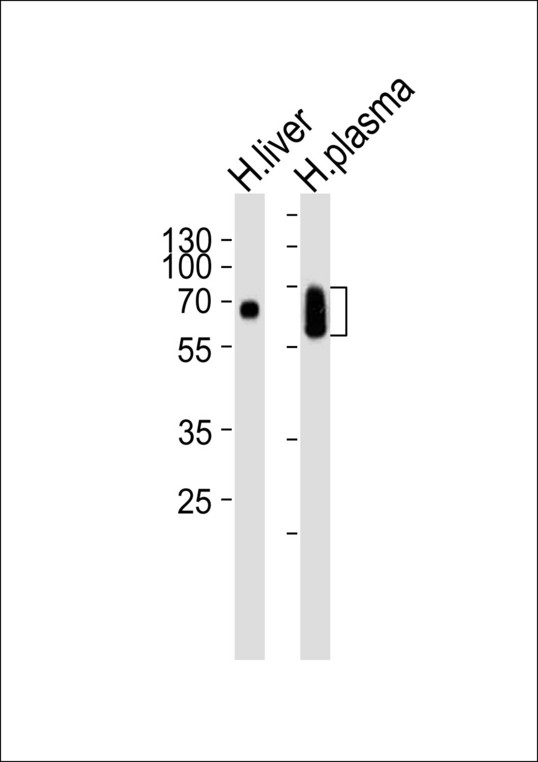 LP-PLA2 / PLA2G7 Antibody - Western blot of lysates from human liver and plasma tissue lysate (from left to right), using PLA2G7 Antibody. Antibody was diluted at 1:1000 at each lane. A goat anti-rabbit IgG H&L (HRP) at 1:10000 dilution was used as the secondary antibody. Lysates at 35ug per lane.