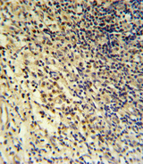 LP-PLA2 / PLA2G7 Antibody - PLA2G7 Antibody IHC of formalin-fixed and paraffin-embedded tonsil followed by peroxidase-conjugated secondary antibody and DAB staining.