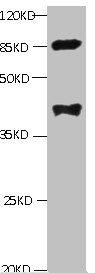 LP-PLA2 / PLA2G7 Antibody - All lanes: Mouse anti-human Platelet-activating factor acetylhydrolase monoclonal Antibody at 1ug/ml Lane 1:mouse spleen tissue Secondary:HRP labeled Goat polyclonal to Mouse IgG at 1/3000 dilution Predicted band size : 48kd Observed band size : 44kd Additional bands at: 85kd