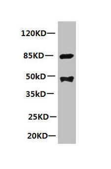 LP-PLA2 / PLA2G7 Antibody - All lanes: Mouse anti-human Platelet-activating factor acetylhydrolase monoclonal Antibody at 1ug/ml Lane 1:mouse spleen tissue Secondary:HRP labeled Goat polyclonal to Mouse IgG at 1/3000 dilution Predicted band size : 48kd Observed band size : 44kd Additional bands at: 85kd