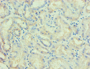 LP-PLA2 / PLA2G7 Antibody - Immunohistochemical of paraffin-embedded human kidney tissue using PLA2G7 Monoclonal Antibody at dilution of 1:200.
