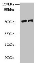 LP-PLA2 / PLA2G7 Antibody - Western blot All lanes: PLA2G7 antibody at 9µg/ml Lane 1: RAW264.7 whole cell lysate Lane 2: Mouse liver tissue Secondary Goat polyclonal to rabbit IgG at 1/10000 dilution Predicted band size: 50 kDa Observed band size: 50 kDa
