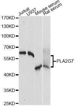 LP-PLA2 / PLA2G7 Antibody - Western blot analysis of extracts of various cell lines, using PLA2G7 Antibody at 1:1000 dilution. The secondary antibody used was an HRP Goat Anti-Rabbit IgG (H+L) at 1:10000 dilution. Lysates were loaded 25ug per lane and 3% nonfat dry milk in TBST was used for blocking. An ECL Kit was used for detection and the exposure time was 3s.
