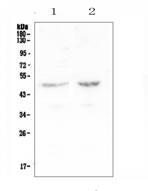 LP-PLA2 / PLA2G7 Antibody - Western blot analysis of PAFAH using anti-PAFAH antibody. Electrophoresis was performed on a 5-20% SDS-PAGE gel at 70V (Stacking gel) / 90V (Resolving gel) for 2-3 hours. The sample well of each lane was loaded with 50ug of sample under reducing conditions. Lane 1: human Caco-2 whole cell lysate,Lane 2: human SW620 whole cell lysate. After Electrophoresis, proteins were transferred to a Nitrocellulose membrane at 150mA for 50-90 minutes. Blocked the membrane with 5% Non-fat Milk/ TBS for 1.5 hour at RT. The membrane was incubated with rabbit anti-PAFAH antigen affinity purified polyclonal antibody at 0.5 µg/mL overnight at 4°C, then washed with TBS-0.1% Tween 3 times with 5 minutes each and probed with a goat anti-rabbit IgG-HRP secondary antibody at a dilution of 1:10000 for 1.5 hour at RT. The signal is developed using an Enhanced Chemiluminescent detection (ECL) kit with Tanon 5200 system. A specific band was detected for PAFAH at approximately 50KD. The expected band size for PAFAH is at 50KD.