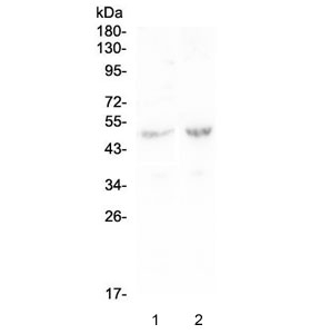 LP-PLA2 / PLA2G7 Antibody - Western blot testing of human 1) Caco-2 and 2) SW620 lysate with PLA2G7 antibody at 0.5ug/ml. Predicted molecular weight ~50 kDa.