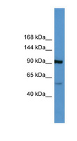 LPA / Lipoprotein a Antibody - LPA antibody Western blot of Jurkat lysate.  This image was taken for the unconjugated form of this product. Other forms have not been tested.
