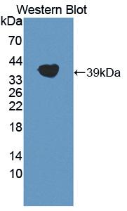 LPA / Lipoprotein a Antibody - Western blot of LPA / Lipoprotein a antibody.