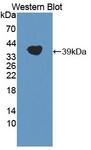 LPA / Lipoprotein a Antibody - Western blot of LPA / Lipoprotein a antibody.